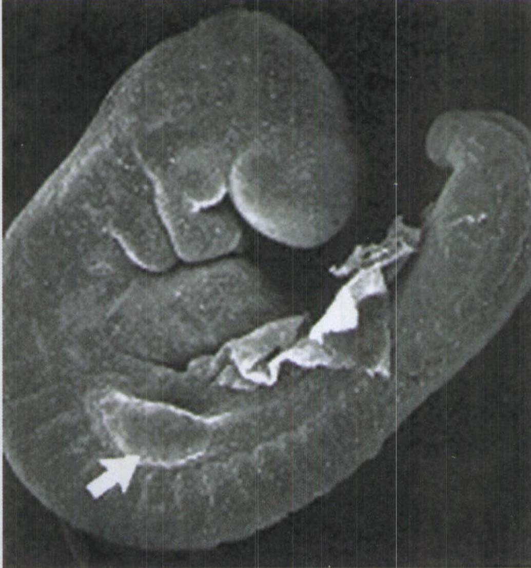 图1-1 第24天胚胎